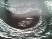 baby 8 weeks 3 days.jpg