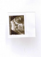 baby20wks.jpeg.jpg