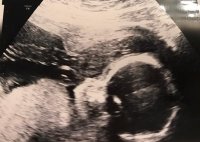 Week 20_BabyNelly.jpg