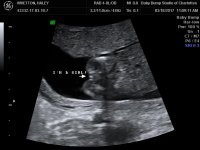 BABY WHETTON_1_2.jpg