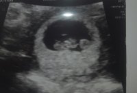 20170422_180946.jpg