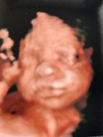 Baby Nelly_28 Weeks.jpg