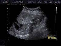 baby3-3.jpg