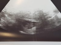Baby #2 8wd5.jpg