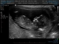 Baby #4 12 weeks.jpg