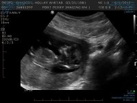 Baby #4 12 weeks 2.jpg