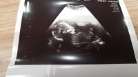 baby pic.jpg