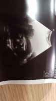 its a boy!!.jpg