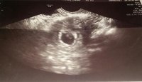 scan 10-4-17 6w4d.jpg