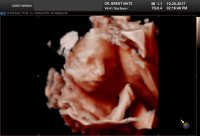 BABY_0091.jpg