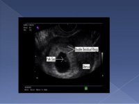 basic-obstetric-ultrasound-22-638.jpg