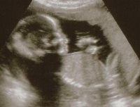 secondscan1.jpg