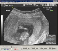 12 weeks 003.jpg
