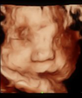 baby boy 4d scan.jpg