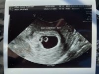6w1d ultrasound.jpeg