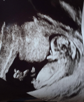 baby scan x.PNG