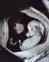 baby scan 2.PNG