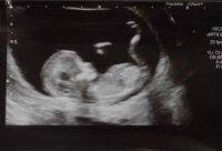 BabyTwoman12w6d.jpg