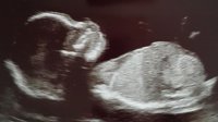 20180302_000424.jpg
