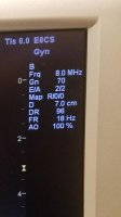 Screenshot_20180410-102453.jpg