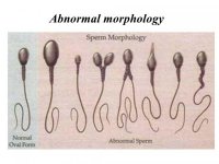 Abnormal+morphology.jpg
