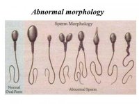 Abnormal+morphology.jpg