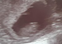 Peanut-2.jpg