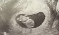 littleBlob.jpg