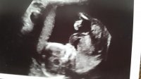 Baby17wks.jpg