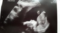 Baby17wks2.jpg