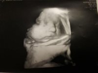 20180925_180841.jpg