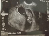 Ultrasound - 11w (small).jpg