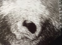 baby.jpeg