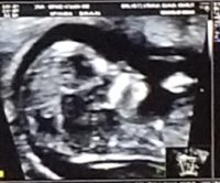 20181010_182647.jpg