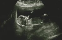 Ultrasound - 14w profile.jpg