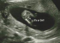 Ultrasound - 14w potty shot.jpg