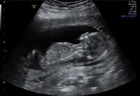 babyvaughan2555.jpg