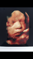 A61B7C64-5D22-4F79-8182-6C9CA283C379.png