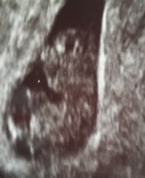 20181128_140453.jpg