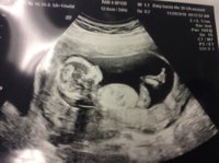BABY 14 weeks.jpeg