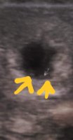 20181210_224734.jpg