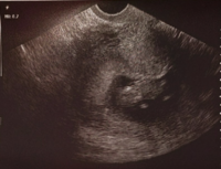 121818scan.png