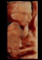 Breelyn1.jpg