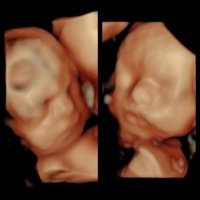 27 weeks.jpg