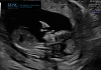 ACDDD634-2E71-44DC-9405-B686720990DE.jpeg
