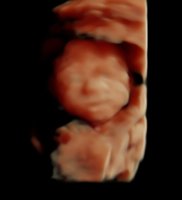 Breelyn (3).jpg