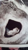 baby2.jpg