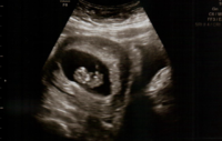 babycropped2.png
