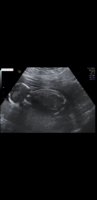 Screenshot_20190415-110726_Video Player.jpg