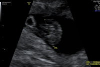 01291396-AD8E-4703-AED0-D6CFED517FD4.jpeg